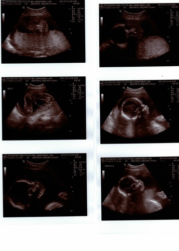 Ultrasound images 20121115